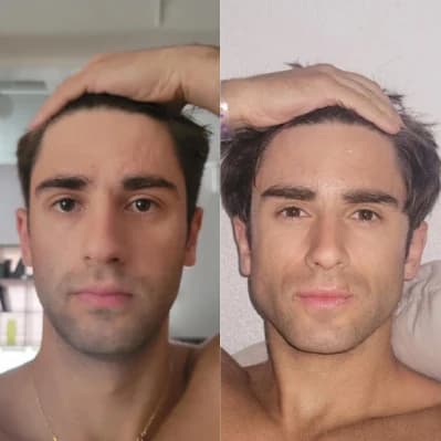 تدليك الوجه بأداة SCULPT