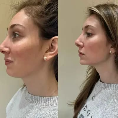 تفاصيل أداة SCULPT عن قرب